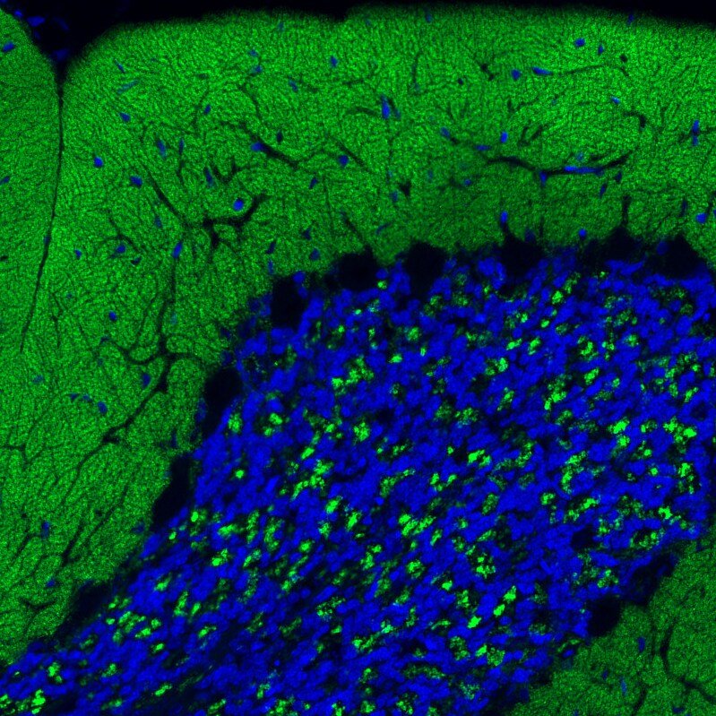 VGLUT1 Antibody (CL2754) - Azide and BSA Free Immunohistochemistry-Paraffin: VGLUT1 Antibody [NBP3-43811]