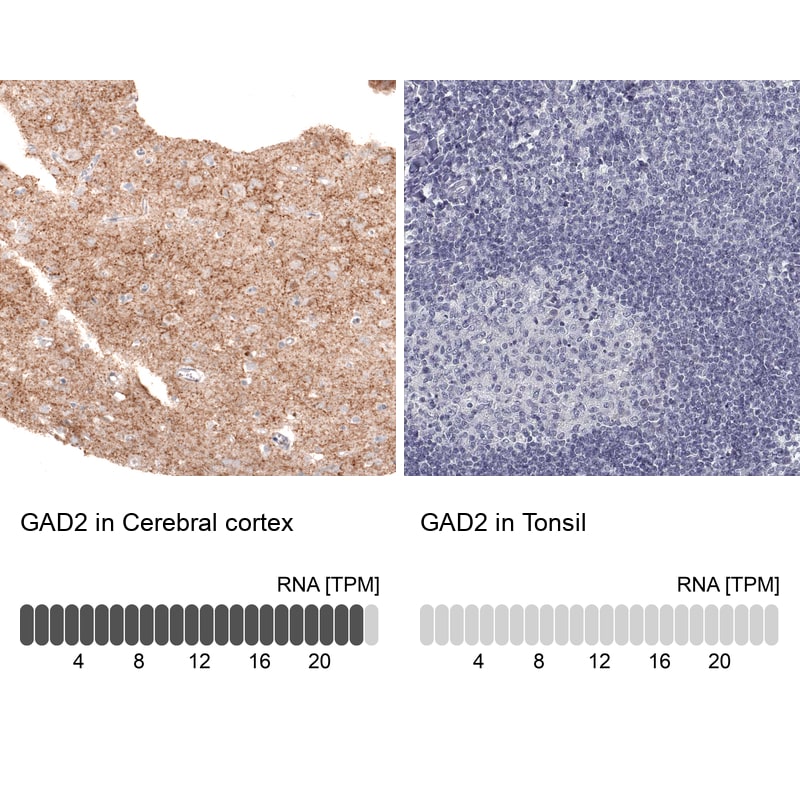 GAD2/GAD65 Antibody (CL2736) - Azide and BSA Free Immunohistochemistry-Paraffin: GAD2/GAD65 Antibody [NBP3-43815]