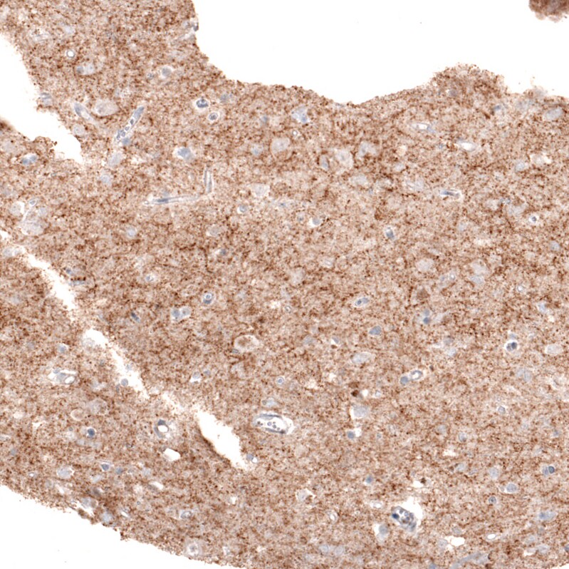 GAD2/GAD65 Antibody (CL2736) - Azide and BSA Free Immunohistochemistry-Paraffin: GAD2/GAD65 Antibody [NBP3-43815]