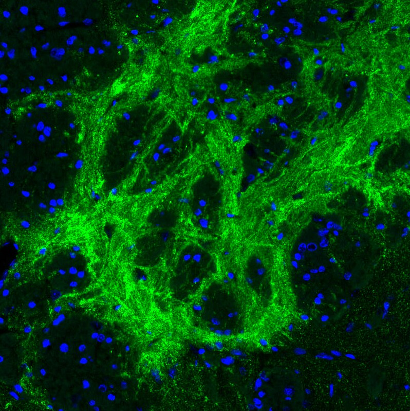 GAD2/GAD65 Antibody (CL2736) - Azide and BSA Free Immunohistochemistry-Paraffin: GAD2/GAD65 Antibody [NBP3-43815]