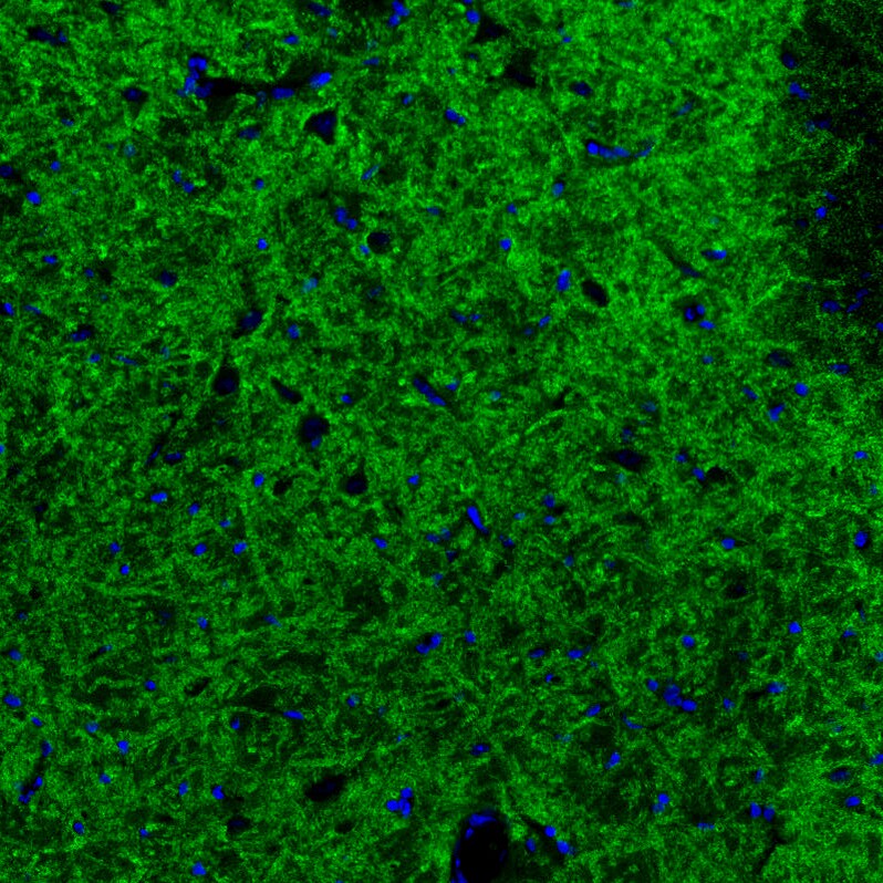 GAD2/GAD65 Antibody (CL2736) - Azide and BSA Free Immunohistochemistry-Paraffin: GAD2/GAD65 Antibody [NBP3-43815]