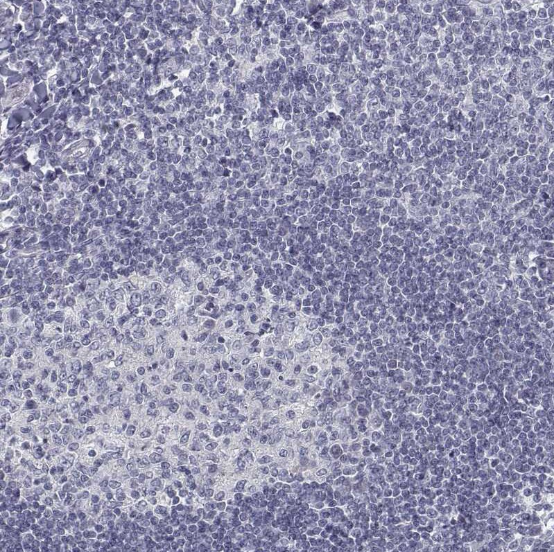 GAD2/GAD65 Antibody (CL2736) - Azide and BSA Free Immunohistochemistry-Paraffin: GAD2/GAD65 Antibody [NBP3-43815]