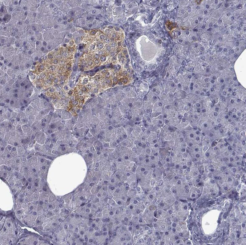 GAD2/GAD65 Antibody (CL2736) - Azide and BSA Free Immunohistochemistry-Paraffin: GAD2/GAD65 Antibody [NBP3-43815]