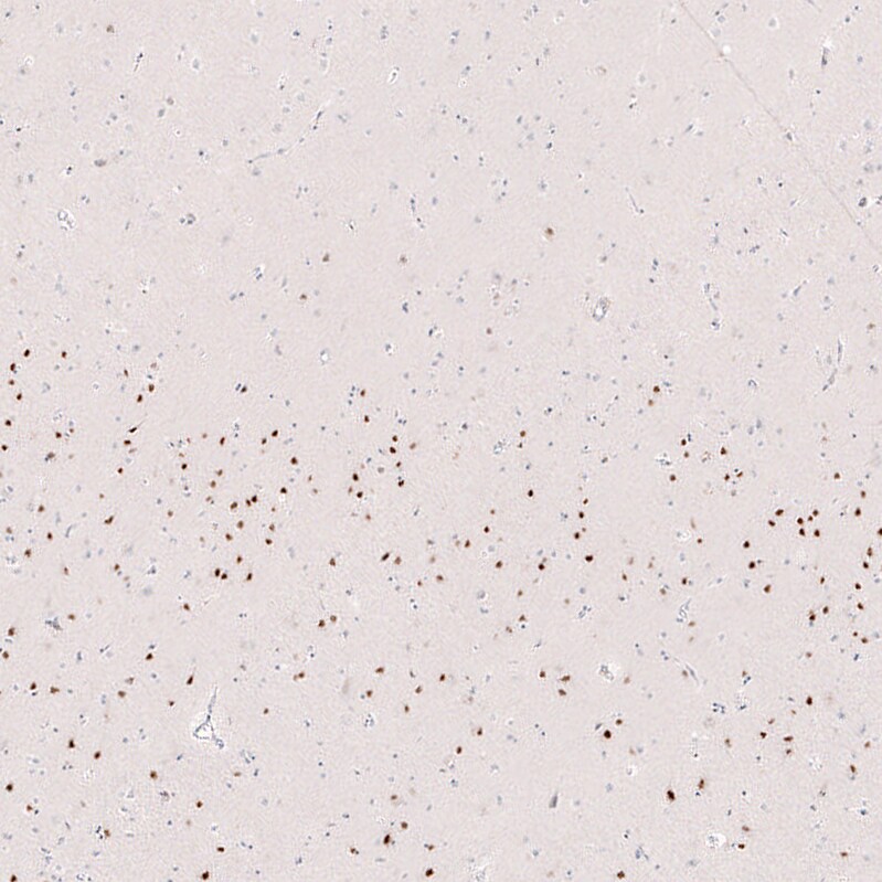 FoxP2 Antibody (CL5310) - Azide and BSA Free Immunohistochemistry-Paraffin: FoxP2 Antibody [NBP3-43816]