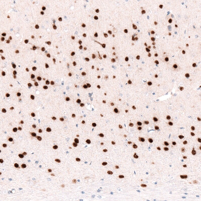 FoxP2 Antibody (CL5310) - Azide and BSA Free Immunohistochemistry-Paraffin: FoxP2 Antibody [NBP3-43816]