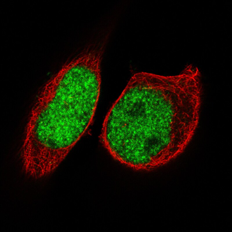FoxP2 Antibody (CL5310) - Azide and BSA Free Immunocytochemistry/ Immunofluorescence: FoxP2 Antibody [NBP3-43816]