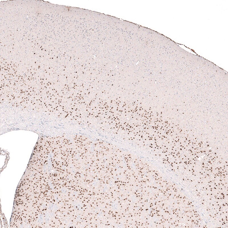 FoxP2 Antibody (CL5310) - Azide and BSA Free Immunohistochemistry-Paraffin: FoxP2 Antibody [NBP3-43816]