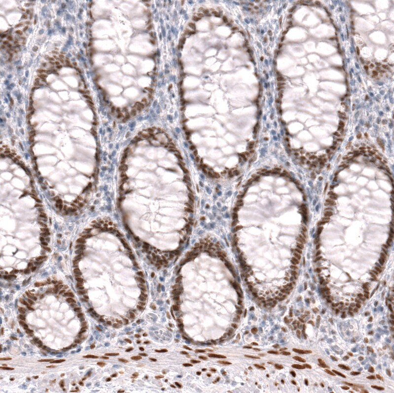 FoxP2 Antibody (CL5310) - Azide and BSA Free Immunohistochemistry-Paraffin: FoxP2 Antibody [NBP3-43816]
