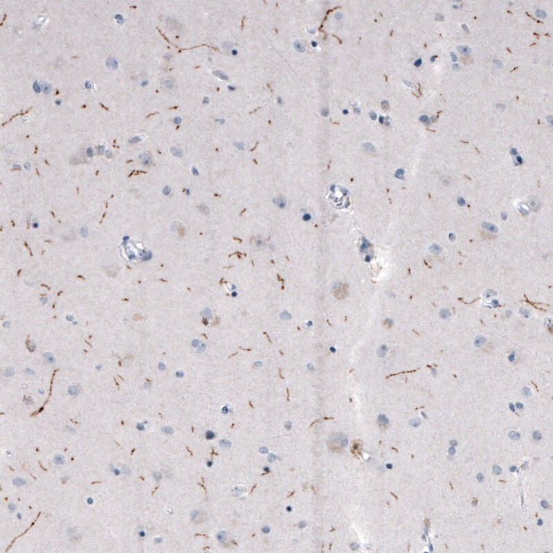 Tryptophan hydroxylase 2 Antibody (CL2990) - Azide and BSA Free Immunohistochemistry-Paraffin: Tryptophan hydroxylase 2 Antibody [NBP3-43817]