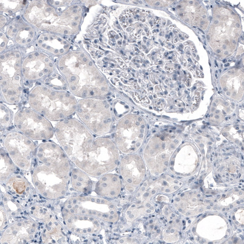 Tryptophan hydroxylase 2 Antibody (CL2990) - Azide and BSA Free Immunohistochemistry-Paraffin: Tryptophan hydroxylase 2 Antibody [NBP3-43817]