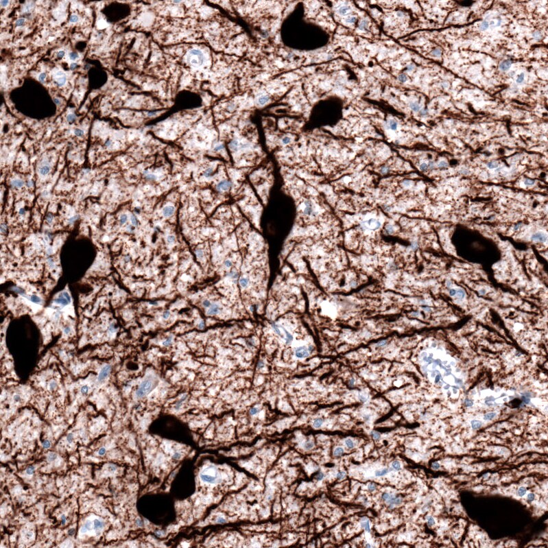 Tryptophan hydroxylase 2 Antibody (CL2990) - Azide and BSA Free Immunohistochemistry-Paraffin: Tryptophan hydroxylase 2 Antibody [NBP3-43817]