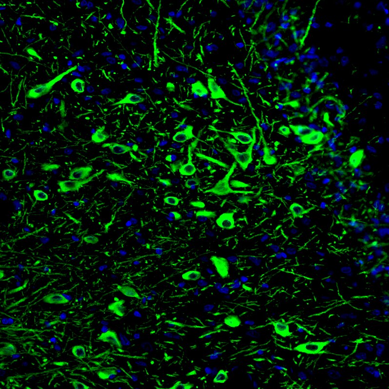 Tryptophan hydroxylase 2 Antibody (CL2990) - Azide and BSA Free Immunohistochemistry-Paraffin: Tryptophan hydroxylase 2 Antibody [NBP3-43817]