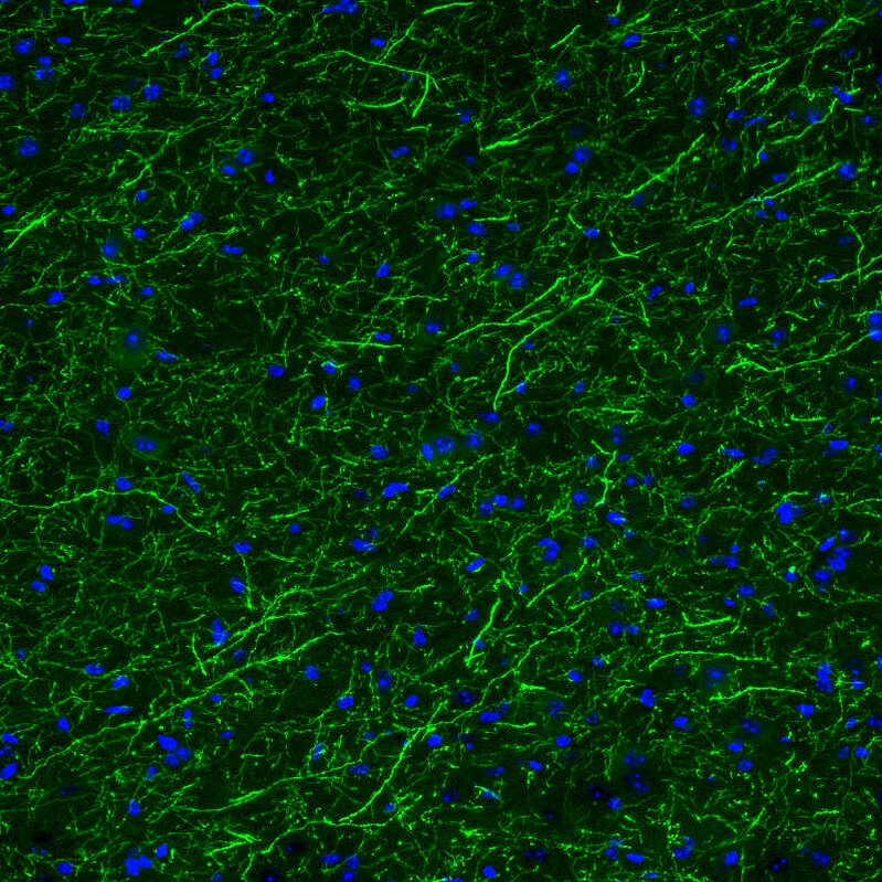 Tryptophan hydroxylase 2 Antibody (CL2990) - Azide and BSA Free Immunohistochemistry-Paraffin: Tryptophan hydroxylase 2 Antibody [NBP3-43817]