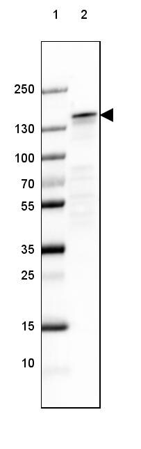 NF-M Antibody (CL2678) - Azide and BSA Free Western Blot: NF-M Antibody [NBP3-43819]