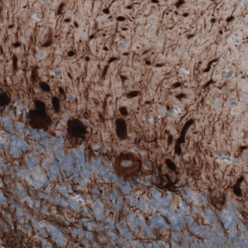 NF-M Antibody (CL2678) - Azide and BSA Free Immunohistochemistry-Paraffin: NF-M Antibody [NBP3-43819]
