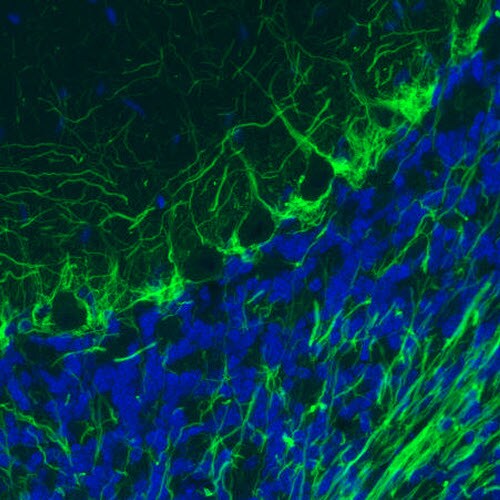 NF-M Antibody (CL2678) - Azide and BSA Free Immunohistochemistry-Paraffin: NF-M Antibody [NBP3-43819]
