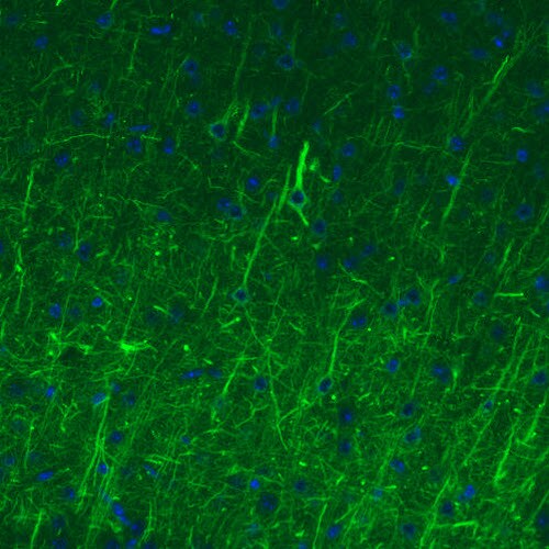 NF-M Antibody (CL2678) - Azide and BSA Free Immunohistochemistry-Paraffin: NF-M Antibody [NBP3-43819]