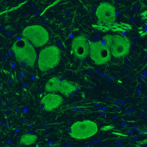 NF-M Antibody (CL2678) - Azide and BSA Free Immunohistochemistry-Paraffin: NF-M Antibody [NBP3-43819]