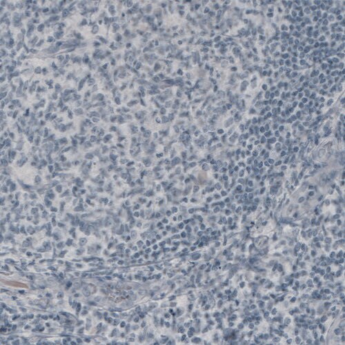NF-M Antibody (CL2678) - Azide and BSA Free Immunohistochemistry-Paraffin: NF-M Antibody [NBP3-43819]