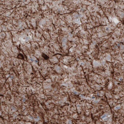 NF-M Antibody (CL2688) - Azide and BSA Free Immunohistochemistry-Paraffin: NF-M Antibody [NBP3-43820]