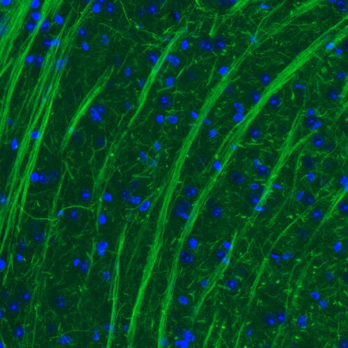 NF-M Antibody (CL2688) - Azide and BSA Free Immunohistochemistry-Paraffin: NF-M Antibody [NBP3-43820]