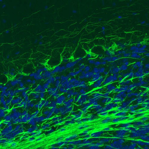 NF-M Antibody (CL2688) - Azide and BSA Free Immunohistochemistry-Paraffin: NF-M Antibody [NBP3-43820]