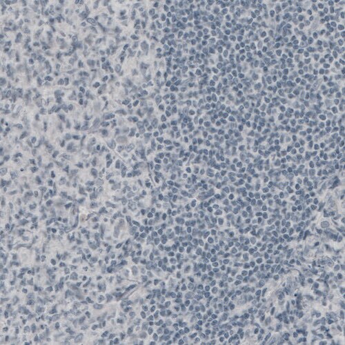 NF-M Antibody (CL2688) - Azide and BSA Free Immunohistochemistry-Paraffin: NF-M Antibody [NBP3-43820]