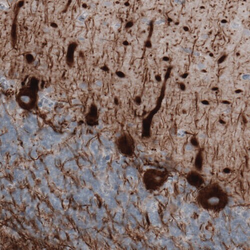NF-M Antibody (CL2697) - Azide and BSA Free Immunohistochemistry-Paraffin: NF-M Antibody [NBP3-43821]