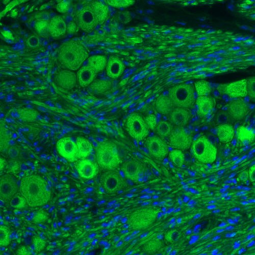 NF-M Antibody (CL2697) - Azide and BSA Free Immunohistochemistry-Paraffin: NF-M Antibody [NBP3-43821]