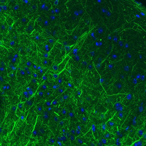 NF-M Antibody (CL2697) - Azide and BSA Free Immunohistochemistry-Paraffin: NF-M Antibody [NBP3-43821]