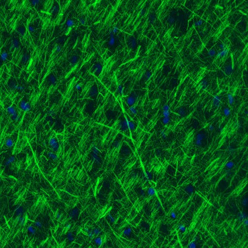 NF-M Antibody (CL2697) - Azide and BSA Free Immunohistochemistry-Paraffin: NF-M Antibody [NBP3-43821]