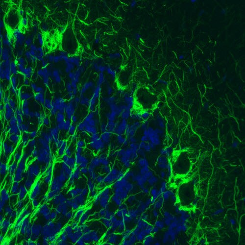 NF-M Antibody (CL2705) - Azide and BSA Free Immunohistochemistry-Paraffin: NF-M Antibody [NBP3-43822]