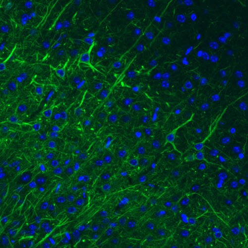 NF-M Antibody (CL2705) - Azide and BSA Free Immunohistochemistry-Paraffin: NF-M Antibody [NBP3-43822]