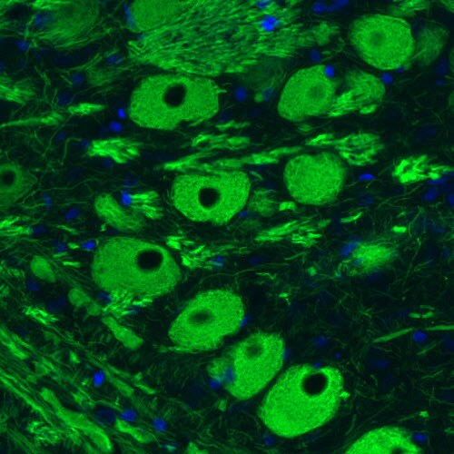 NF-M Antibody (CL2705) - Azide and BSA Free Immunohistochemistry-Paraffin: NF-M Antibody [NBP3-43822]