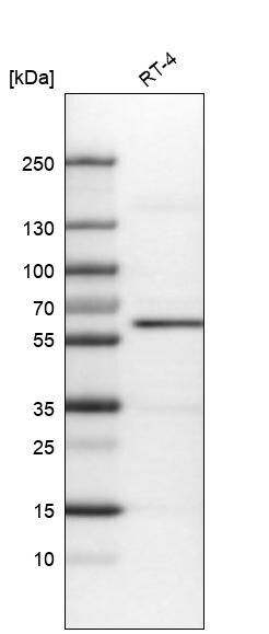 AKT1 Antibody (CL0899) - Azide and BSA Free Western Blot: AKT1 Antibody [NBP3-43824]