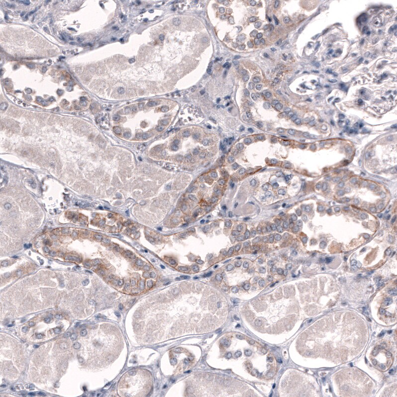 ADAM10 Antibody (CL13808) - Azide and BSA Free Immunohistochemistry-Paraffin: ADAM10 Antibody [NBP3-43825]
