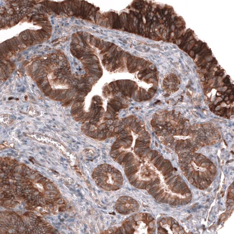 ADAM10 Antibody (CL13808) - Azide and BSA Free Immunohistochemistry-Paraffin: ADAM10 Antibody [NBP3-43825]