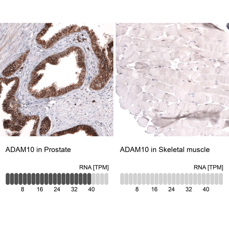 ADAM10 Antibody (CL13808) - Azide and BSA Free Immunohistochemistry-Paraffin: ADAM10 Antibody [NBP3-43825]