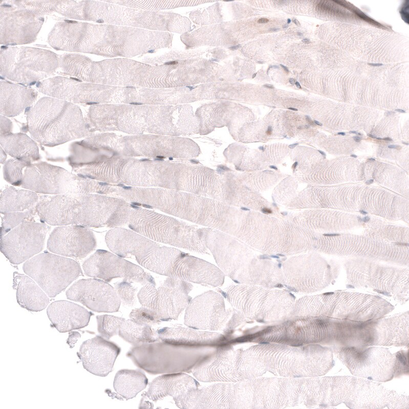 ADAM10 Antibody (CL13808) - Azide and BSA Free Immunohistochemistry-Paraffin: ADAM10 Antibody [NBP3-43825]