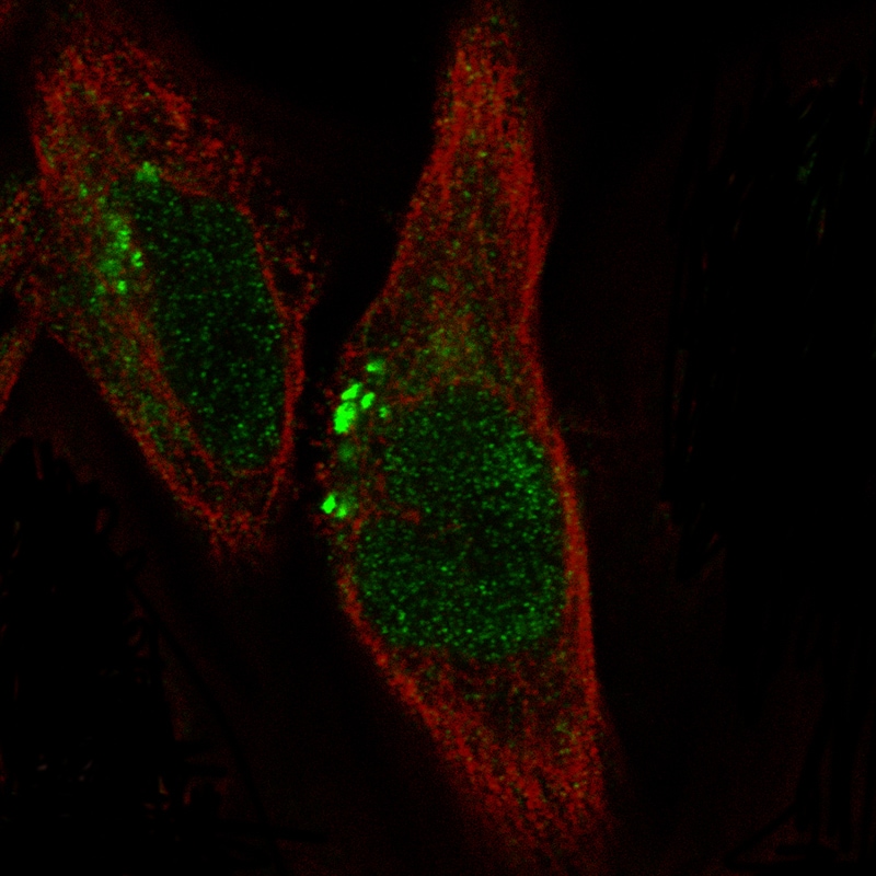 ADAM10 Antibody (CL13814) - Azide and BSA Free Immunocytochemistry/ Immunofluorescence: ADAM10 Antibody [NBP3-43826]