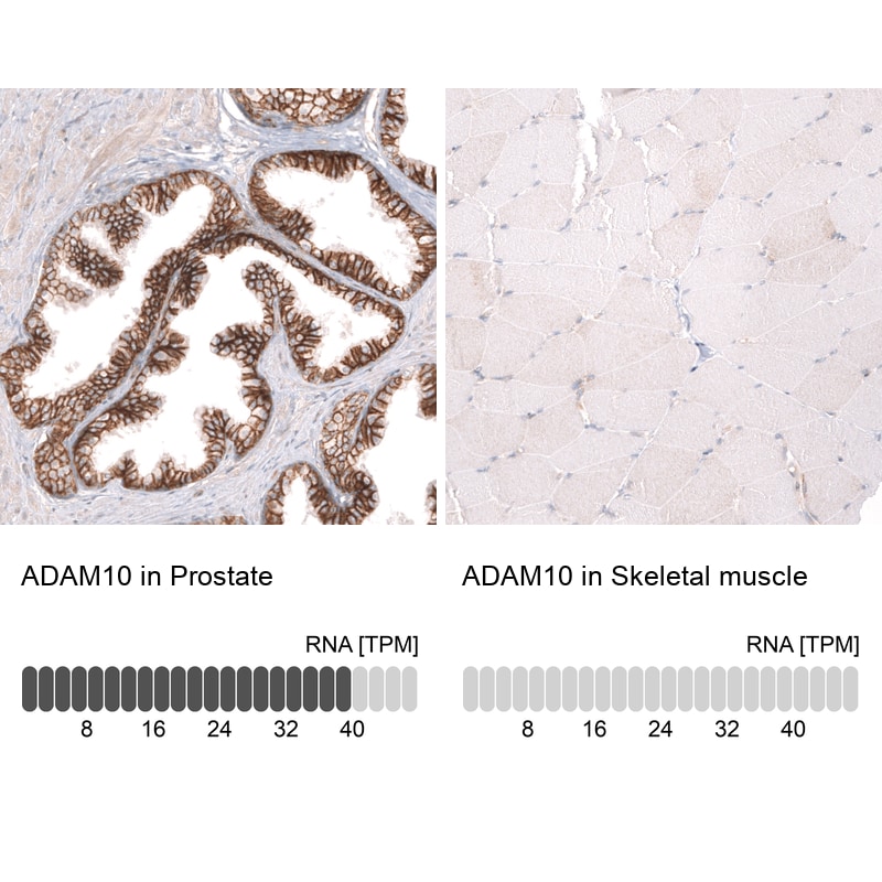 ADAM10 Antibody (CL13814) - Azide and BSA Free Immunohistochemistry-Paraffin: ADAM10 Antibody [NBP3-43826]