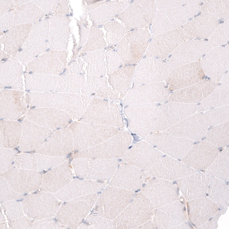 ADAM10 Antibody (CL13814) - Azide and BSA Free Immunohistochemistry-Paraffin: ADAM10 Antibody [NBP3-43826]