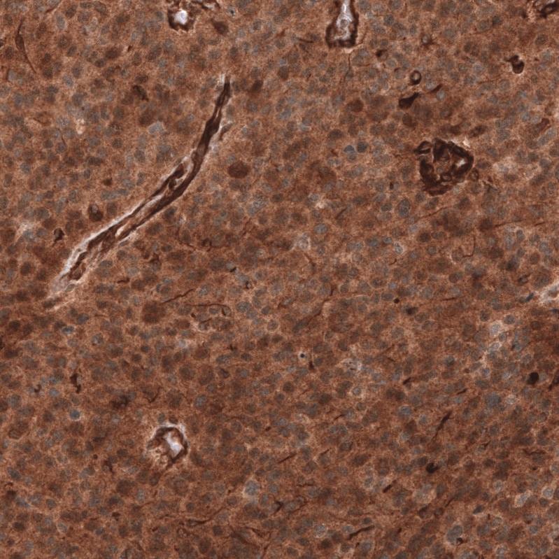 ADAM10 Antibody (CL13815) - Azide and BSA Free Immunohistochemistry-Paraffin: ADAM10 Antibody [NBP3-43827]