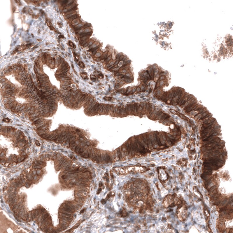 ADAM10 Antibody (CL13815) - Azide and BSA Free Immunohistochemistry-Paraffin: ADAM10 Antibody [NBP3-43827]