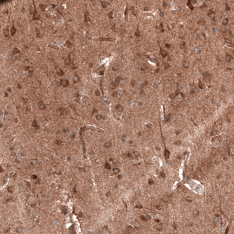 ADAM10 Antibody (CL13815) - Azide and BSA Free Immunohistochemistry-Paraffin: ADAM10 Antibody [NBP3-43827]