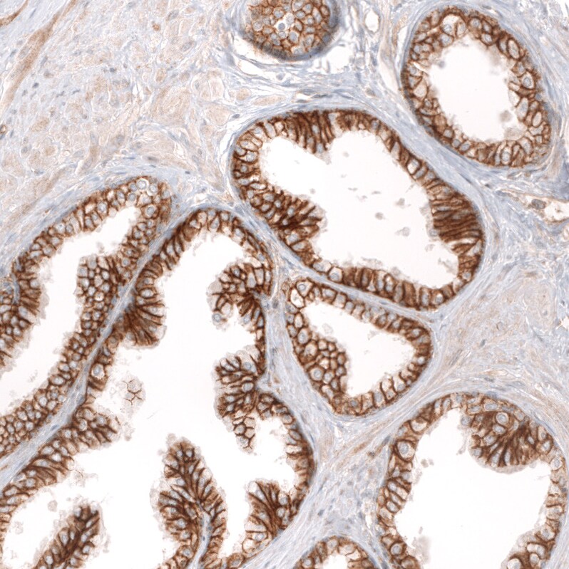 ADAM10 Antibody (CL13815) - Azide and BSA Free Immunohistochemistry-Paraffin: ADAM10 Antibody [NBP3-43827]
