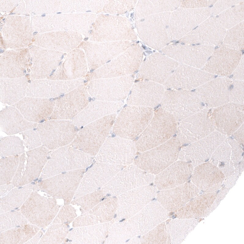 ADAM10 Antibody (CL13815) - Azide and BSA Free Immunohistochemistry-Paraffin: ADAM10 Antibody [NBP3-43827]