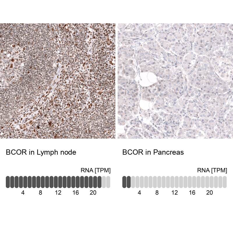 BCOR Antibody (CL13841) - Azide and BSA Free Immunohistochemistry-Paraffin: BCOR Antibody [NBP3-43828]