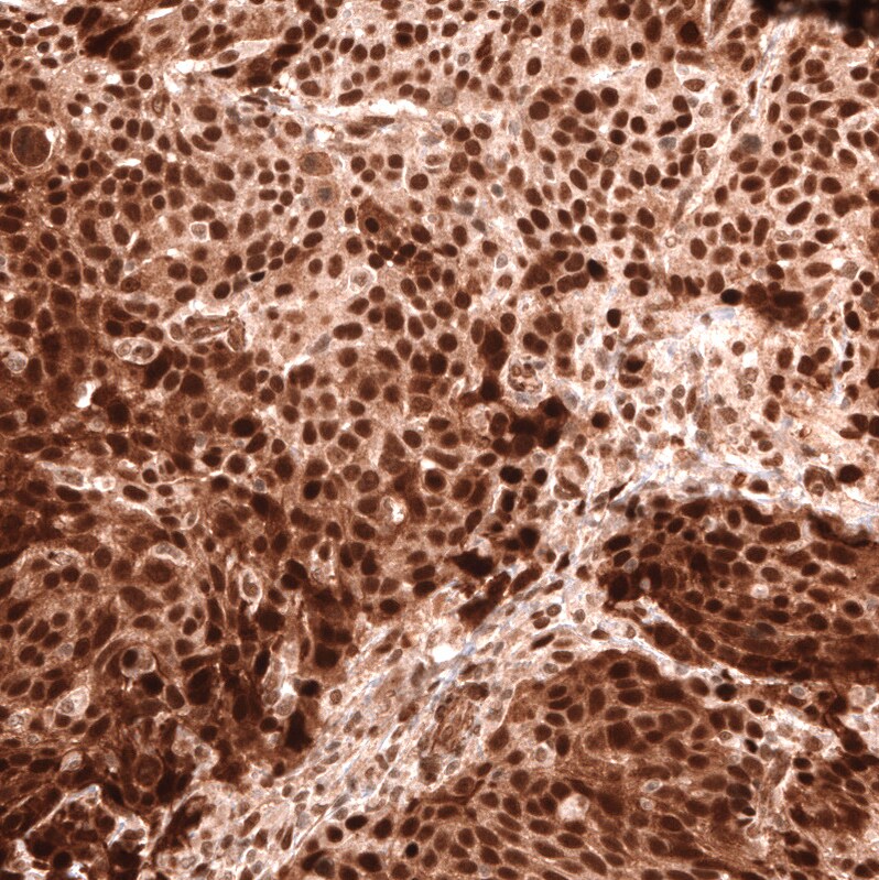 BCOR Antibody (CL13841) - Azide and BSA Free Immunohistochemistry-Paraffin: BCOR Antibody [NBP3-43828]
