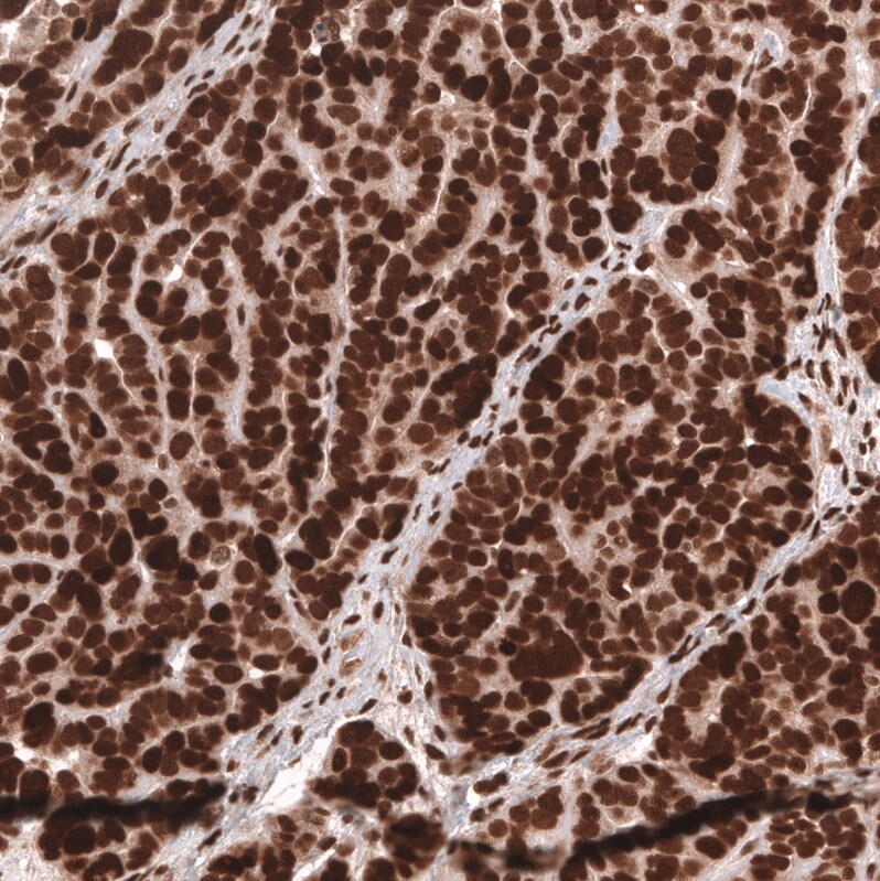 BCOR Antibody (CL13841) - Azide and BSA Free Immunohistochemistry-Paraffin: BCOR Antibody [NBP3-43828]